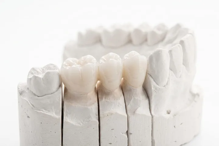 A ceramic dental crown on black glass beside a porcelain shade sample ring